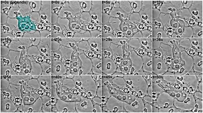Reassessing the Role of Entamoeba gingivalis in Periodontitis